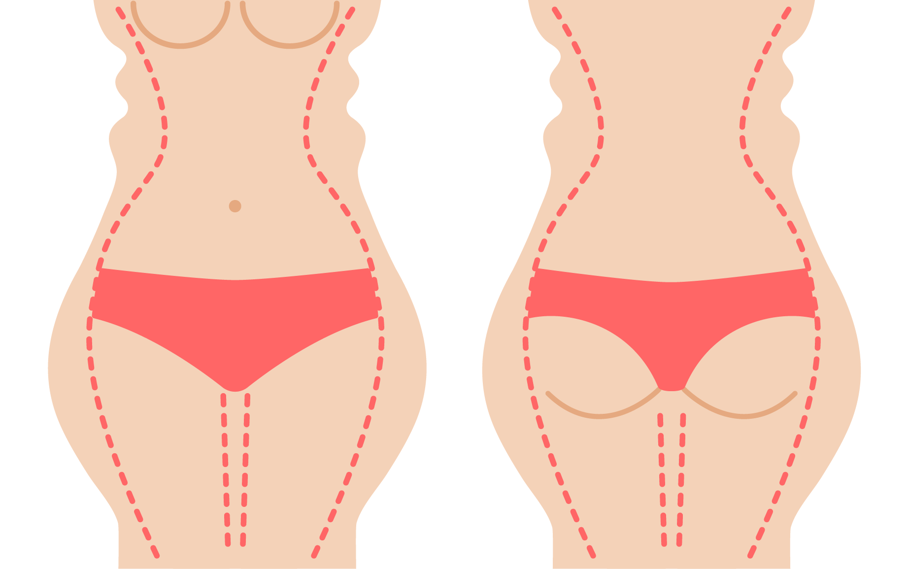 body-contouring-image